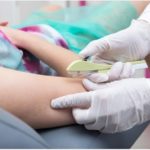 SUS amplia acesso à autonomia feminina com oferta de implante anticoncepcional gratuito